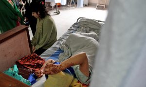 जब दाइ भन्‍नेले नै एसिड छ्याप्यो