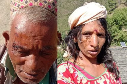 वडा सचिवको नेतृत्वमा पाँचौं पटक दलित समुदायमाथि कुटपिट वडा सचिवको नेतृत्वमा पाँचौं पटक दलित समुदायमाथि कुटपिट